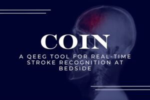 The Neuro Science Monitor (Moberg Analytics) COIN: A qEEG Tool for Real-Time Stroke Recognition at Bedside